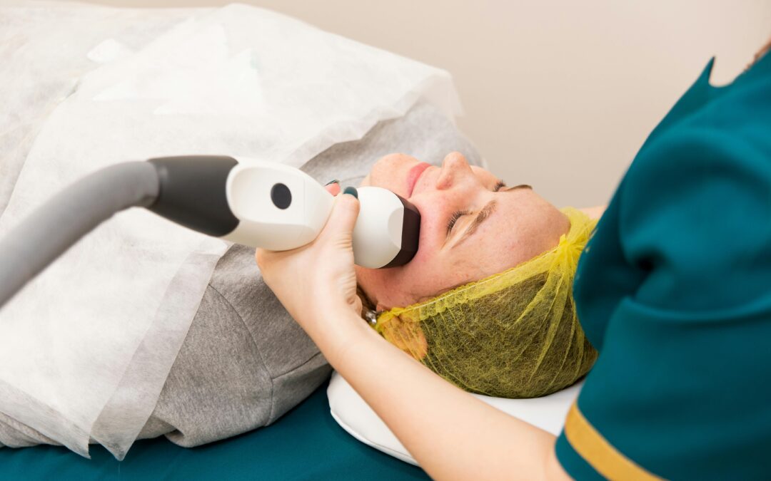 Laserterapia como opción para tratar las cicatrices